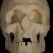 A model of the archer's skull was created on a 3D printer