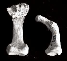 bone deformation